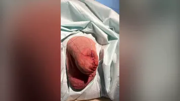 Cock sewing by Dominatrix Mistress April