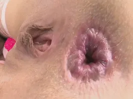 Nickey Huntsman and her talented asshole